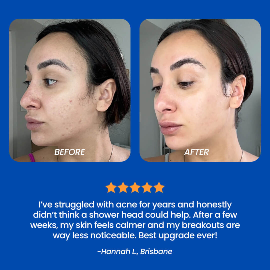 Purity Co™ Everyday Bundle