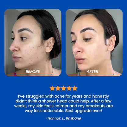 Purity Co™ Everyday Bundle